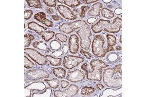 Immunohistochemical staining of human kidney with COX14 polyclonal antibody  shows strong cytoplasmic positivity in cells in tubules. (COX14 抗体)