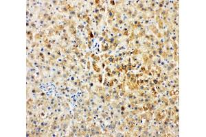 IHC-P: Tec antibody testing of rat liver tissue (NR4A3 抗体  (AA 612-631))