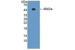 Detection of Recombinant PFKM, Rat using Polyclonal Antibody to Phosphofructokinase, Muscle (PFKM) (PFKM 抗体  (AA 2-390))