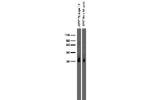 anti-Synapse Differentiation Inducing 1 (SYNDIG1) (AA 1-183), (Cytosolic), (N-Term) antibody