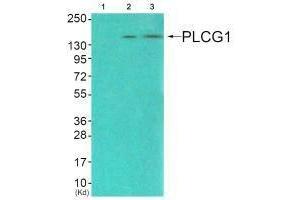 Western blot analysis of extracts from COS7 cells (Lane 2), and JK cells (Lane 3), using PLCG1 (Ab-771) antiobdy. (Phospholipase C gamma 1 抗体  (Tyr771))