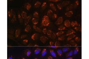 Immunofluorescence analysis of U-2 OS cells using ART1 Polyclonal Antibody at dilution of 1:100. (ART1 抗体)