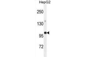 Western Blotting (WB) image for anti-Glycerol-3-Phosphate Acyltransferase, Mitochondrial (GPAM) antibody (ABIN2995540) (GPAM 抗体)