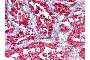 Immunohistochemical analysis of paraffin-embedded human Kidney tissues using GPI mouse mAb. (GPI 抗体)