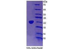 SDS-PAGE analysis of Human TRERF1 Protein. (TRERF1 蛋白)