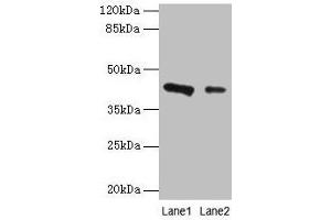 Western blot All lanes: RAD23B antibody at 2 μg/mL Lane 1: 293T whole cell lysate Lane 2: MCF-7 whole cell lysate Secondary Goat polyclonal to rabbit IgG at 1/10000 dilution Predicted band size: 44, 36 kDa Observed band size: 44 kDa (RAD23B 抗体  (AA 1-250))