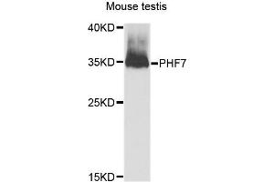 Western blot analysis of extracts of Mouse testis cells, using PHF7 antibody. (PHF7 抗体)