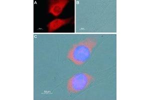 Immunocytochemistry (ICC) image for anti-ATPase, Ca++ Transporting, Cardiac Muscle, Fast Twitch 1 (ATP2A1) (AA 25-37), (Cytosolic) antibody (ABIN7042953)
