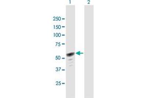 Western Blot analysis of HERPUD1 expression in transfected 293T cell line by HERPUD1 MaxPab polyclonal antibody. (HERPUD1 抗体  (AA 1-391))