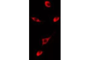 Immunofluorescence (fixed cells) (IF/ICC) image for anti-Cytochrome P450, Family 2, Subfamily D, Polypeptide 6 (CYP2D6) antibody (ABIN6258047)