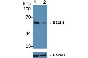 Knockout Varification: ;Lane 1: Wild-type MCF7 cell lysate; ;Lane 2: BECN1 knockout MCF7 cell lysate; ;Predicted MW: 52kDa ;Observed MW: 60kDa;Primary Ab: 3µg/ml Rabbit Anti-Human BECN1 Antibody;Second Ab: 0. (Beclin 1 抗体  (AA 1-273))