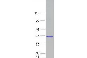 Western Blotting (WB) image for RAB27A, Member RAS Oncogene Family (RAB27A) (Transcript Variant 2) protein (Myc-DYKDDDDK Tag) (ABIN2730307)