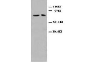 Western blot analysis of rat cardiac muscle tissue lysis using MFN antibody (MFN2 抗体  (N-Term))
