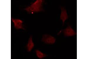 Immunofluorescence (fixed cells) (IF/ICC) image for anti-C-Abl Oncogene 1, Non-Receptor tyrosine Kinase (ABL1) (pTyr393), (pTyr412) antibody (ABIN6256727)