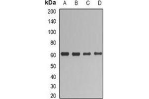 Western blot analysis of UGT1A1 expression in HepG2 (A), SHSY5Y (B), mouse liver (C), rat liver (D) whole cell lysates. (UGT1A1 抗体)