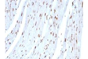 Formalin-fixed, paraffin-embedded rat heart stained with SUMO-2 antibody. (SUMO2 抗体)