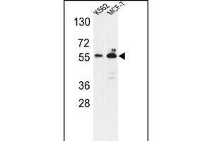 Western blot analysis of G6PD Antibody (Center) (ABIN651286 and ABIN2840171) in K562,MCF-7 cell line lysates (35 μg/lane). (Glucose-6-Phosphate Dehydrogenase 抗体  (AA 297-326))