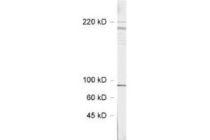 dilution: 1 : 1000, sample: rat hippocampus homogenate (SHANK3 抗体  (AA 1055-1616))