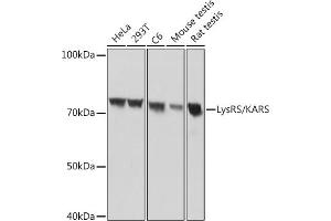 Western blot analysis of extracts of various cell lines, using LysRS/KARS Rabbit mAb (ABIN7268350) at 1:1000 dilution. (KARS 抗体)