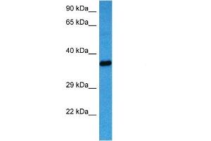 Host:  Mouse  Target Name:  AKR1B1  Sample Tissue:  Mouse Heart  Antibody Dilution:  1ug/ml
