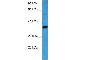 Host:  Mouse  Target Name:  AKR1B1  Sample Tissue:  Mouse Heart  Antibody Dilution:  1ug/ml (AKR1B1 抗体  (C-Term))
