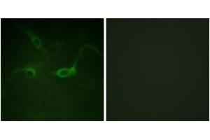 Immunofluorescence analysis of COS7 cells, using FGFR1 (Phospho-Tyr654) Antibody. (FGFR1 抗体  (pTyr654))