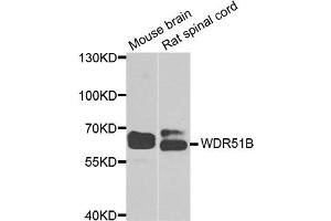 Western blot analysis of extracts of mouse brain and rat spinal cord  cell lines, using WDR51B( POC1B ) antibody. (POC1B 抗体)