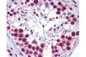 Anti-RSL24D1 / C15orf15 antibody IHC of human testis. (RSL24D1 抗体  (AA 1-151))