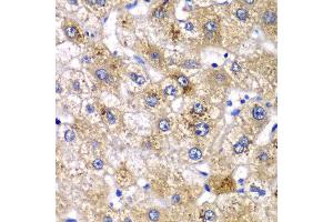 Immunohistochemistry of paraffin-embedded human liver injury using AMY2A antibody at dilution of 1:100 (x40 lens). (AMY2A 抗体)