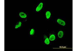 Immunofluorescence of monoclonal antibody to RNF168 on HepG2 cell. (RNF168 抗体  (AA 462-571))