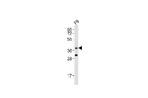Anti-Rnf2 Antibody (Center) at 1:1000 dilution + F9 whole cell lysates Lysates/proteins at 20 μg per lane. (RNF2 抗体  (AA 165-199))