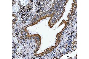 IHC analysis of VAPA using anti-VAPA antibody (ABIN7603249). (VAPA 抗体  (N-Term))