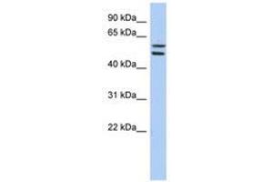 Image no. 1 for anti-Zinc Finger Protein 513 (ZNF513) (AA 467-516) antibody (ABIN6740630)