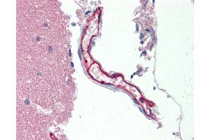 Anti-ABCB1 / MDR1 / P Glycoprotein antibody IHC staining of human vessel.