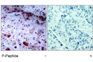 Image no. 1 for anti-Janus Kinase 1 (JAK1) (pTyr1022) antibody (ABIN196868) (JAK1 抗体  (pTyr1022))