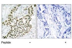 Image no. 3 for anti-H2A Histone Family, Member X (H2AFX) (Ser139) antibody (ABIN197524) (H2AFX 抗体  (Ser139))