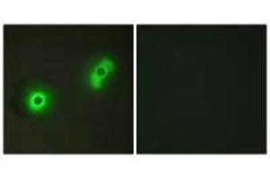 Immunofluorescence analysis of A549 cells, using Ik3-2 antibody. (CABLES2 抗体)