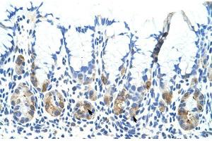 Human Stomach; Rabbit Anti-ADAT1 Antibody. (ADAT1 抗体  (C-Term))