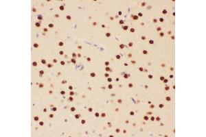 Anti-ATF2 Picoband antibody,  IHC(P): Rat Brain Tissue (ATF2 抗体  (AA 93-450))