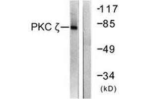 Western blot analysis of extracts from COS7 cells, treated with PMA 125ng/ml 30', using PKC zeta (Ab-560) Antibody.