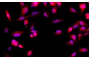 Immunofluorescence analysis of U-251MG cells using BRCA2 Polyclonal Antibody at dilution of 1:100 (BRCA2 抗体)