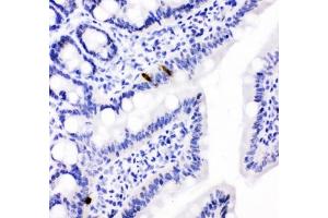 IHC testing of FFPE rat intestine with PYY antibody. (Peptide YY 抗体  (AA 29-64))