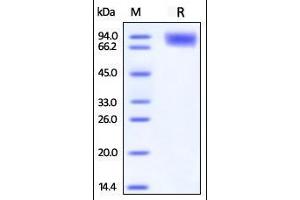 SDS-PAGE (SDS) image for CD226 (CD226) (AA 19-247) (Active) protein (Fc Tag) (ABIN2870817)