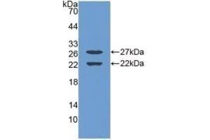 Detection of Recombinant EGR1, Mouse using Polyclonal Antibody to Early Growth Response Protein 1 (EGR1) (EGR1 抗体  (AA 273-431))