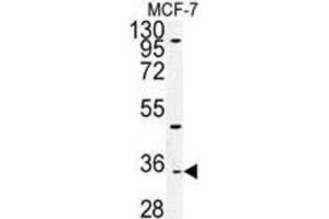 Western Blotting (WB) image for anti-Tocopherol (Alpha) Transfer Protein-Like (TTPAL) antibody (ABIN3002253) (TTPAL 抗体)