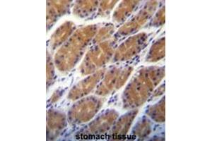 CLDN2 Antibody (C-term pTyr195) immunohistochemistry analysis in formalin fixed and paraffin embedded human stomach tissue followed by peroxidase conjugation of the secondary antibody and DAB staining. (Claudin 2 抗体  (C-Term))