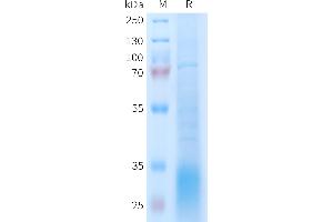 SDS-PAGE (SDS) image for Glucagon-Like Peptide 2 Receptor (GLP2R) (AA 1-173) protein (His tag) (ABIN7538300)