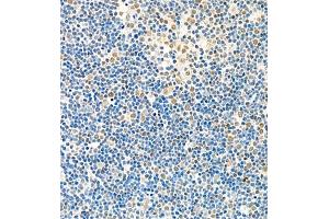 Immunohistochemistry of paraffin embedded rat thymus using Skar (ABIN7074970) at dilution of 1:1800 (400x lens) (p46 抗体)