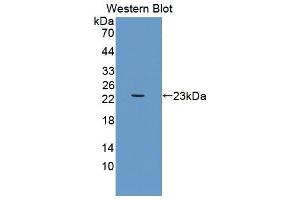 Western blot analysis of the recombinant protein. (UACA 抗体  (AA 29-209))