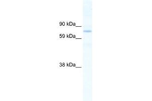 WB Suggested Anti-SIN3B Antibody Titration:  2.